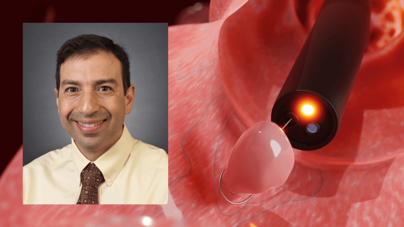 A photograph of this article's author, Dr. Jose Raul Monzon, is shown over a rendering of a colonoscope being used to remove a polyp. 